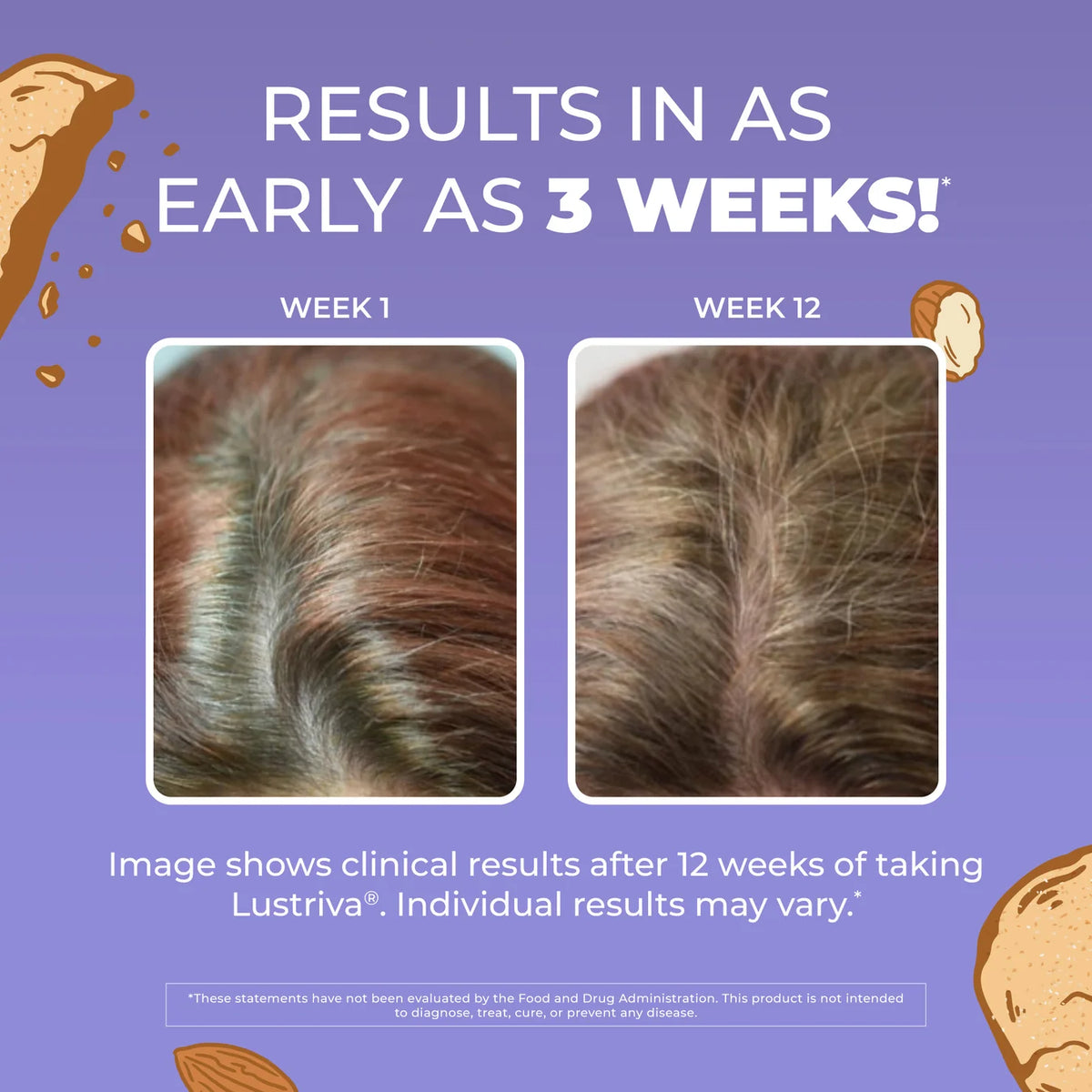 Mary ruth Hair Growth Max Liposomal 450ML